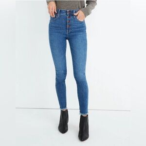 Madewell 10” High Rise Skinny Jeans in Mackey Wash: Button Front Edition